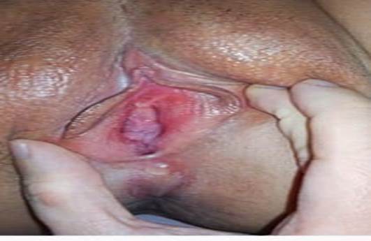 Natural ways to keep your Vigina tight